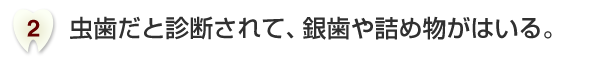 虫歯だと診断されて、銀歯や詰め物がはいる。