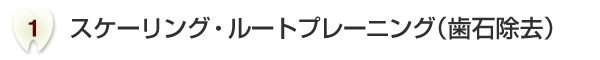 スケーリング・ルートプレーニング（歯石除去）