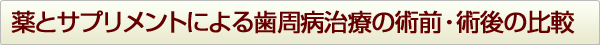 薬とサプリメントによる歯周病治療の術前・術後の比較